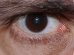 Auge-2